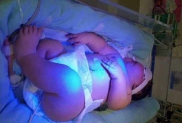 Bebê surpreende médicos e nasce pesando 7 quilos na Maternidade Dona Evangelina Rosa